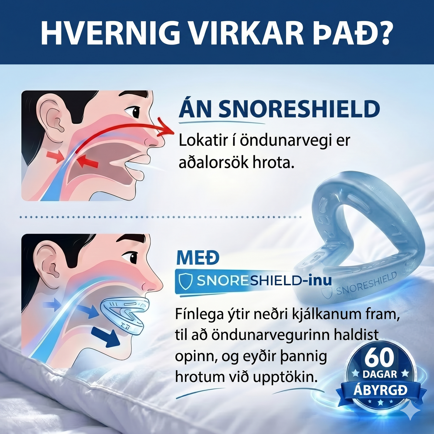 Munnvörn gegn hrota – SnoreShield™